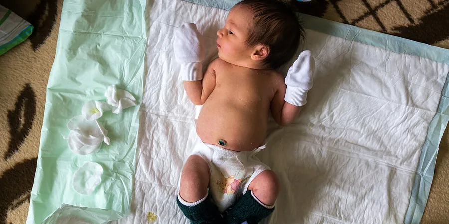 Top 10 Best Baby Diapers